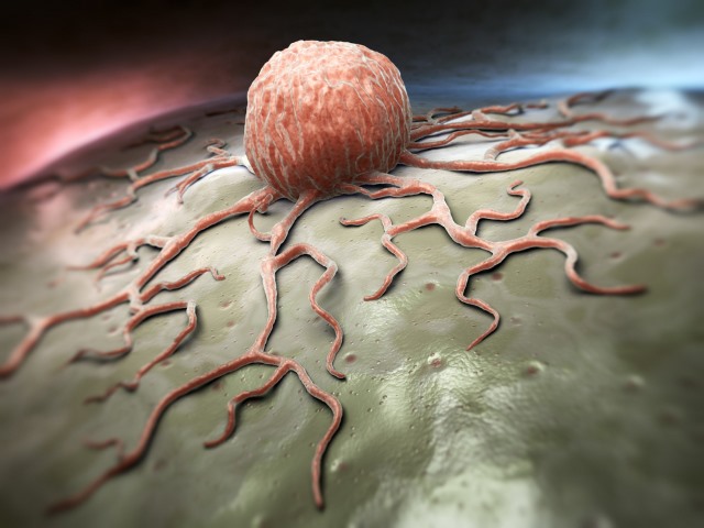 cancer_cells