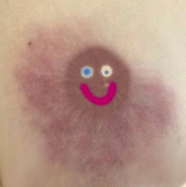 smiley_nipple